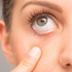 Чувство инородного тела в глазу — причины и лечение