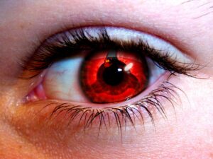 Покраснение глаз: когда стоит обратиться к врачу?