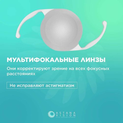 Какие типы факичных интраокулярных линз существуют?